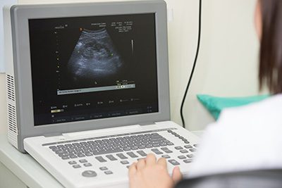 free pregnancy ultrasound